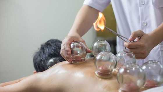 Traditional Fire Cupping