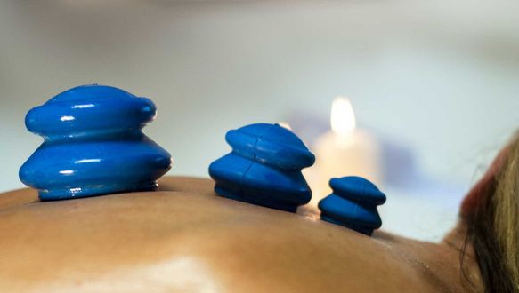 Chinese Cupping Massage